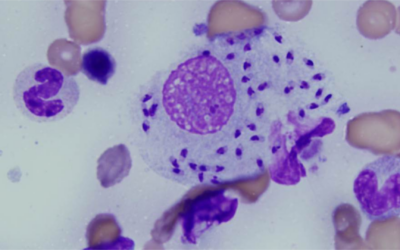 leishmania